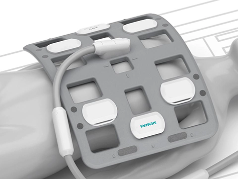 Siemens MAGNETOM Amira 1.5T MRI Review: Practical Performance for Routine Imaging